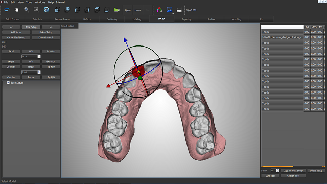3D-printed braces