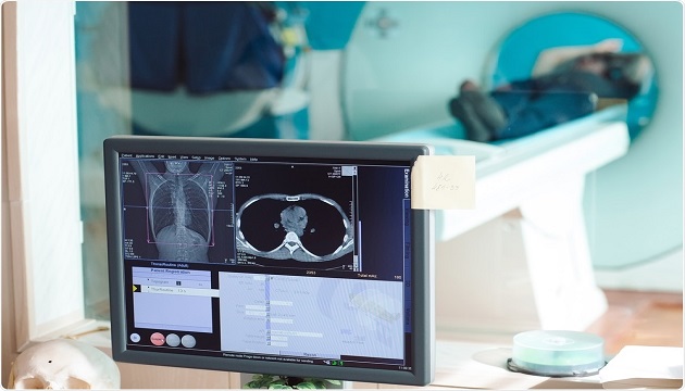AI in MRI