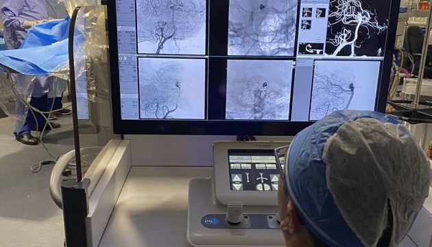 brain aneurysms treatment with robotics