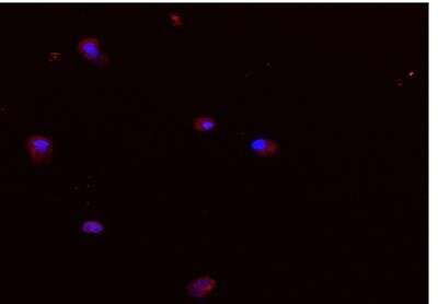 Scientists use Nanotechnology to Detect Bone-Healing Stem Cells