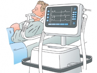 Ventilator Accuracy and Reliability