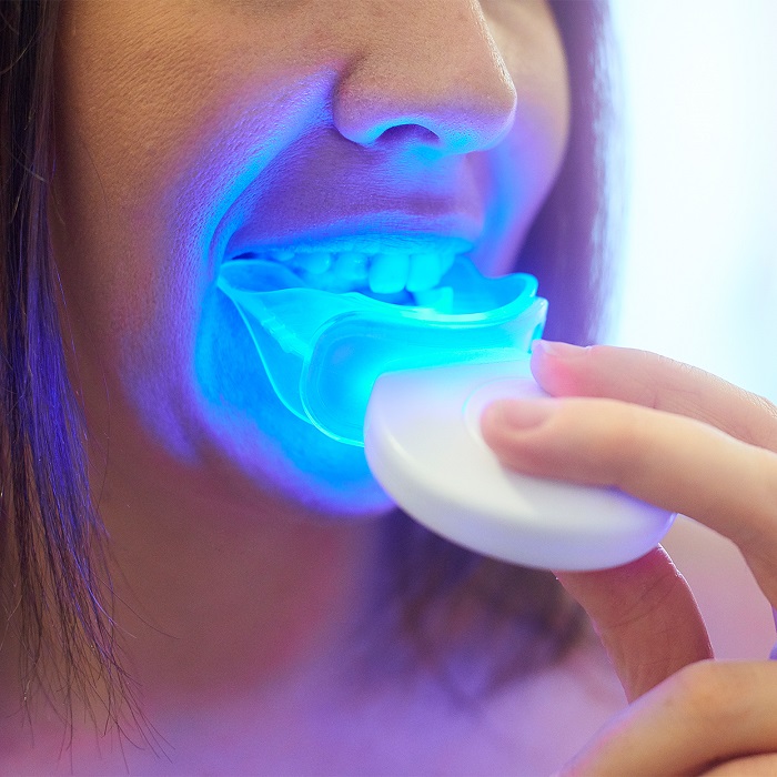 LED Teeth Witnessing LED Teeth Witnessing